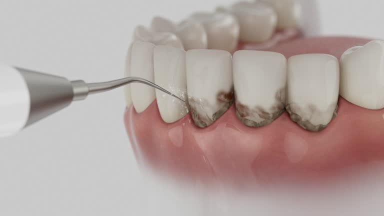 Trusted Dental Implants service in Colorado City, TX - Dentist Open Now